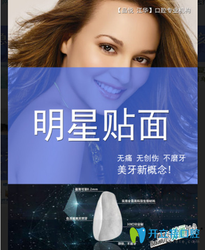 明星貼面 明星貼面