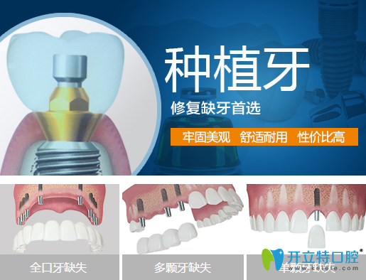 牙齒缺失說話漏風(fēng)？德陽新橋口腔種植牙幫你改善缺牙問題
