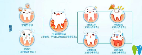 患有牙周病的人平時(shí)應(yīng)注意些什么？