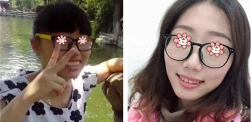 事實證明沈陽愛齒口腔張小龍給我做的齙牙矯正效果蠻好！
