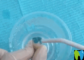 用水加壓沖洗牙面