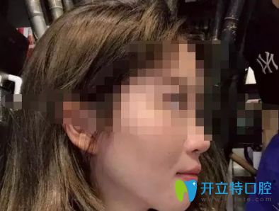 沒(méi)想到效果真的很好，我很感謝西安諾貝爾