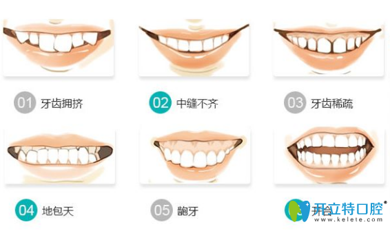 哪些情況牙齒需要矯正？牙齒矯正需要多少時間？