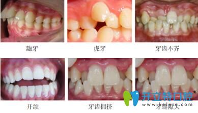 長沙美萊口腔牙齒矯正不設(shè)年齡，讓您洋溢燦爛的笑容