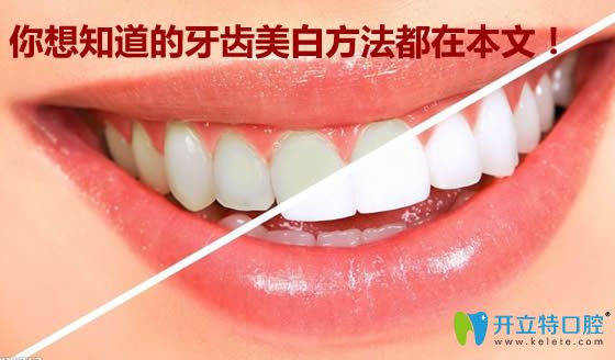 想了解牙齒美白的小竅門,有關(guān)牙黃變白的祖?zhèn)鞣椒ǘ荚谶@里