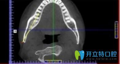 長(zhǎng)沙美萊口腔牙齒矯正優(yōu)勢(shì)詳細(xì)測(cè)量數(shù)據(jù)