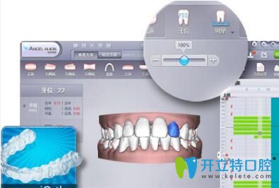 長(zhǎng)沙美萊口腔可視效果評(píng)估