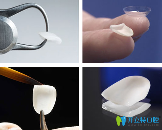 石家莊樂(lè)昂口腔門(mén)診部牙貼面宣傳圖