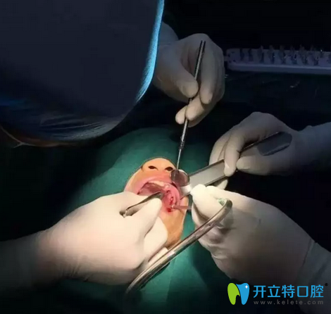 佛山拜博口腔1小時<span style=