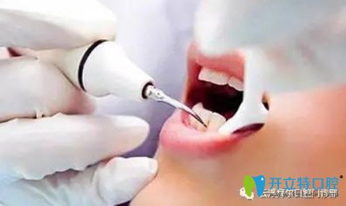 云浮拜爾口腔微創(chuàng)無(wú)痛拔牙技術(shù) 云浮拜爾口腔微創(chuàng)無(wú)痛拔牙技術(shù)