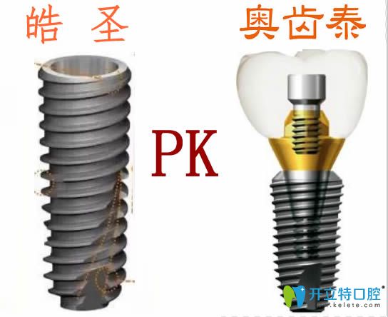 美國皓圣和韓國奧齒泰哪個種植體好？價格及使用壽命大PK