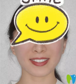 美樂口腔金屬托槽矯正牙齒18個月<span style=