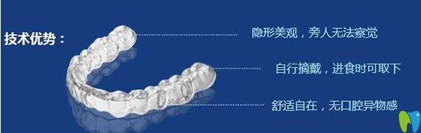 佳士潔口腔隱形牙齒較真優(yōu)勢(shì)