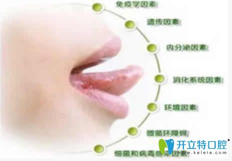 經(jīng)?？谇粷兪鞘裁丛蚣爸委煼椒ù笕? border=