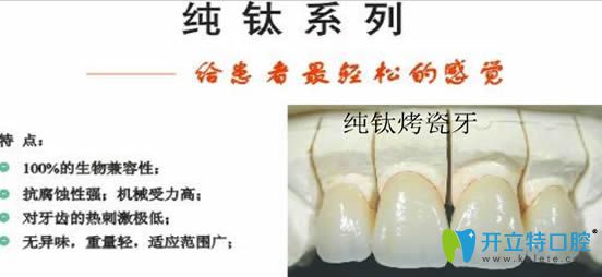 ardc-srvc.com純鈦烤瓷牙圖片