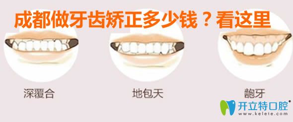 成都做牙齒矯正的價(jià)格是多少錢