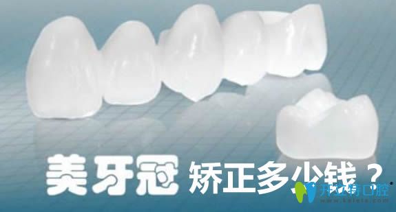 美容冠牙齒矯正大概需要多少錢?請看本文提供的價(jià)格一覽表
