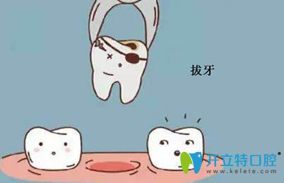 開立特牙齒松動怎么治療之拔牙