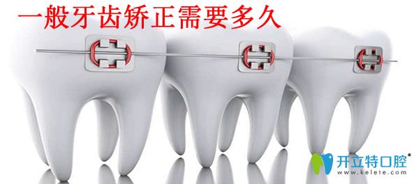 探訪重慶牙齒整形多少錢 牙齒矯正需要多長(zhǎng)時(shí)間恢復(fù)
