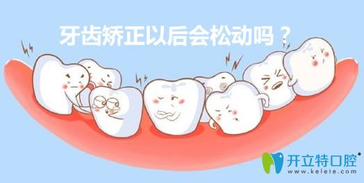 華美口腔醫(yī)生姚廣楠科普矯正牙齒以后會(huì)松動(dòng)嗎