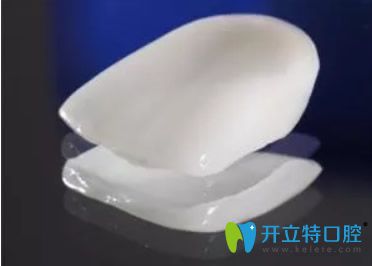 牙齒瓷貼面外形