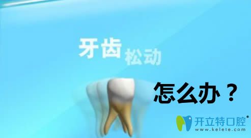 牙齒松動怎么治療？做修復(fù)的話價格大概需要多少錢？