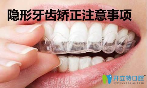 武漢壹加壹口腔周寧科普隱形牙齒矯正注意事項