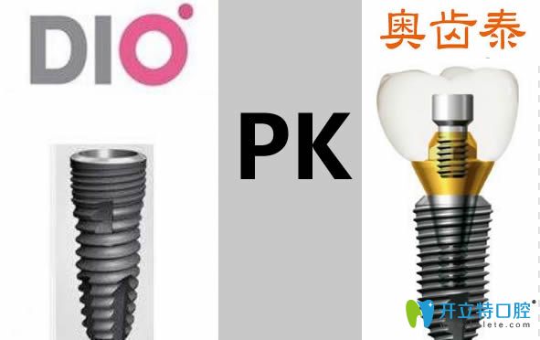 韓國dio和奧齒泰哪個好?兩者種植體的價格/壽命/材質(zhì)大PK