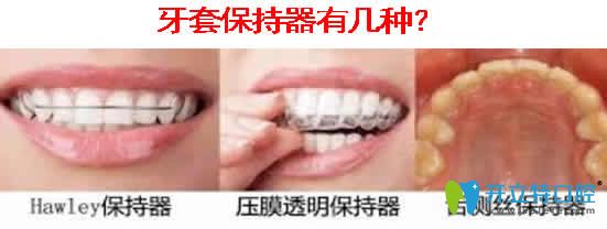 牙套保持器有幾種