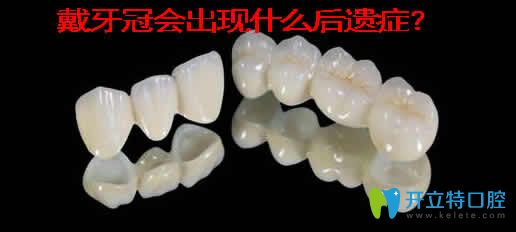 戴牙冠會(huì)出現(xiàn)什么后遺癥？介紹牙冠的種類及價(jià)格