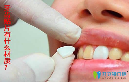 本文介紹牙齒貼片的材質(zhì)和價(jià)格及牙齒貼片的優(yōu)缺點(diǎn)