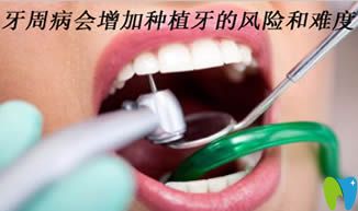 杭州植得口腔解析:牙周病為什么會增加種植牙的風(fēng)險(xiǎn)和難度