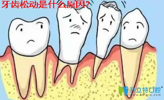 醫(yī)生解析：牙齒松動是什么原因及牙齒松動了能自己恢復(fù)嗎