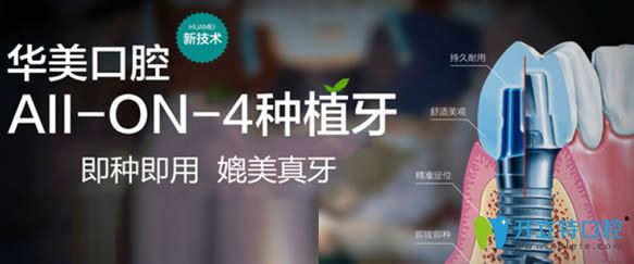 貴陽(yáng)華美牙科種植牙及正畸技術(shù)優(yōu)勢(shì)