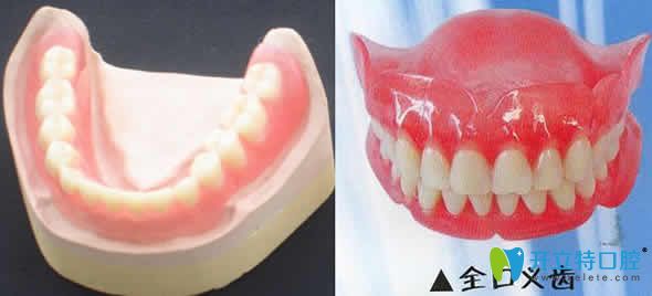 活動(dòng)假牙圖片