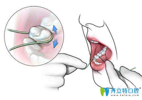 要學(xué)會(huì)使用牙線，保持口腔清潔
