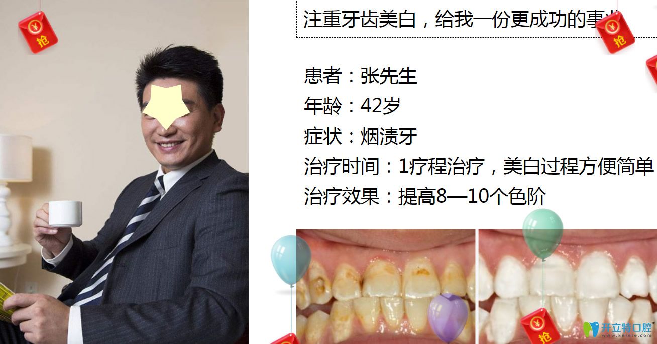 深圳牙齒美白哪里做？格倫菲爾口腔皓齒美白案例公布