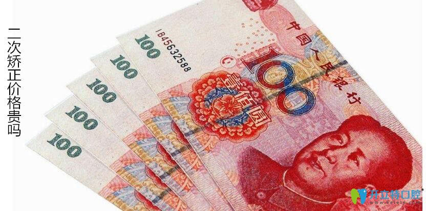 牙齒二次矯正會貴些嗎
