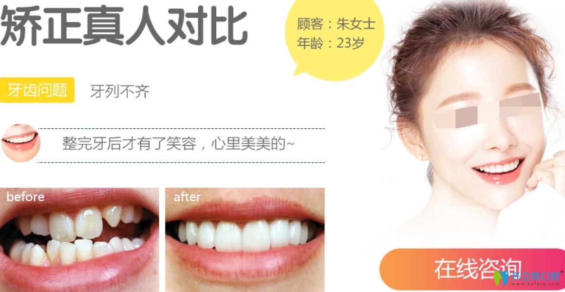 聊城口腔醫(yī)院怎么樣呢？真人牙齒矯正案例效果給你帶來驚喜