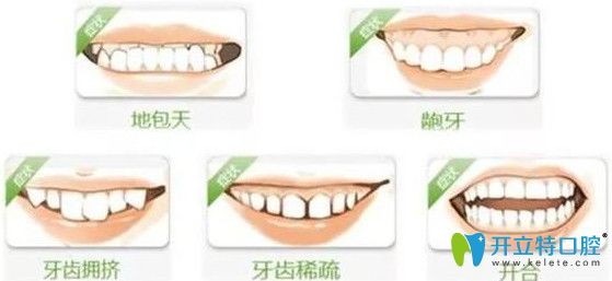 造成牙齒咬合問題的原因