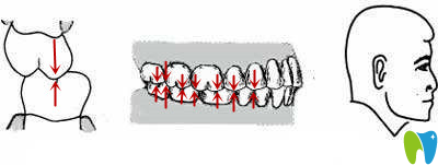 磨牙的關(guān)系