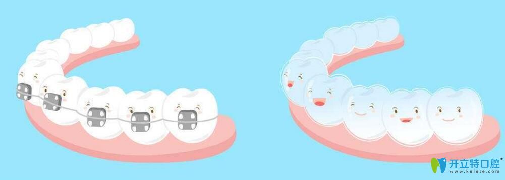 正頜和正畸手術(shù)的區(qū)別？正頜手術(shù)哪里做得好,費用是多少？