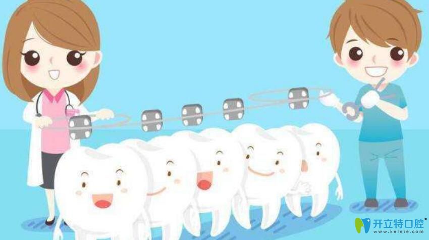 矯牙為什么那么貴？資深牙醫(yī)告訴你不知道的正牙價(jià)格內(nèi)幕