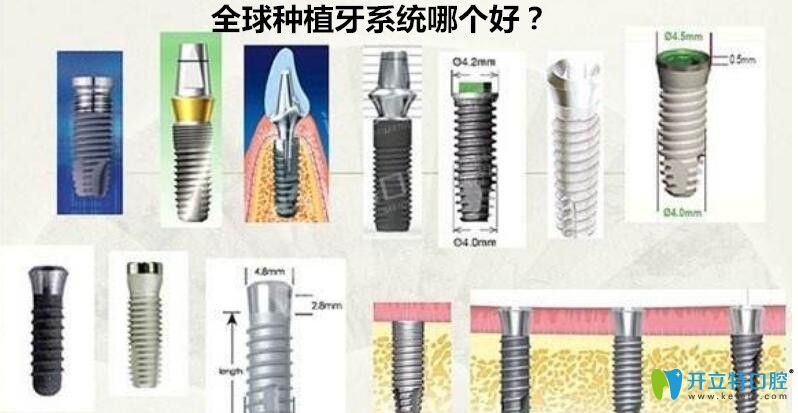 世界種植體品牌排名詳情一覽
