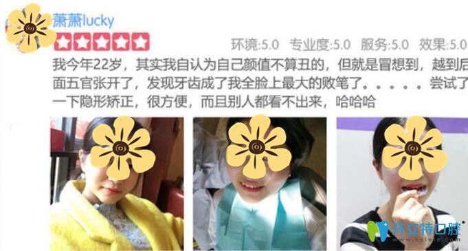 顧客在美奧做隱形矯正牙齒體驗(yàn)后反饋評價(jià)