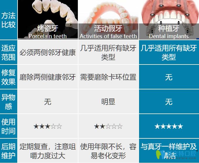 關(guān)于種植牙和活動假牙及烤瓷牙的比較