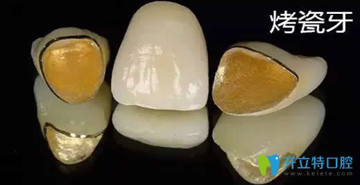 烤瓷牙崩瓷有沒(méi)有毒