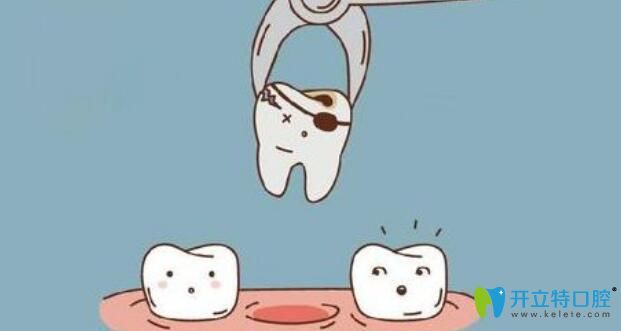 整顆牙齒已經(jīng)裂開(kāi)到壞死的程度時(shí)