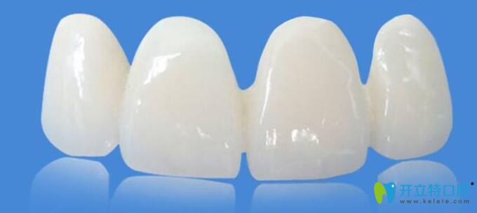 鑄瓷牙和全瓷牙有什么區(qū)別
