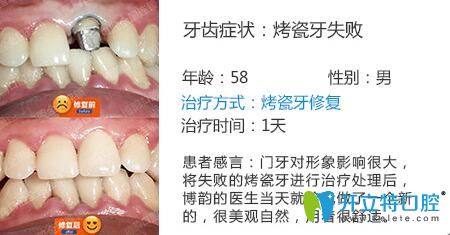 醫(yī)生姓名：周光正   醫(yī)生資質(zhì)：全科醫(yī)生  所屬機(jī)構(gòu)：南京博韻口腔  社會(huì)任職：  畢業(yè)院校：畢業(yè)于邢臺(tái)<!--<i data=20240703-sp></i>-->口腔醫(yī)學(xué)系  主診項(xiàng)目：牙列缺損修復(fù)、口腔種植、前牙美學(xué)修復(fù)、嵌體修復(fù)及復(fù)雜牙拔除。
